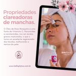 standard_resolution -15-